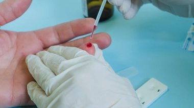 Le dépistage de l'hépatite C est réalisé grâce à une prise de sang