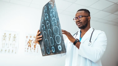 L'IRM cérébrale reste un examen de référence pour diagnostiquer un accident vasculaire cérébral