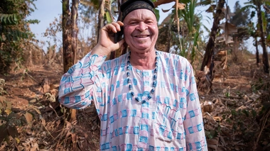 Un Congolais atteint d'albinisme 