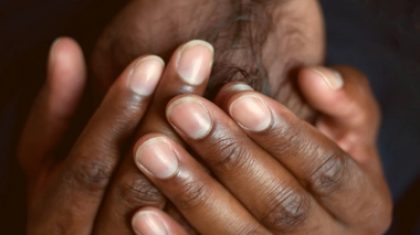 Le déficit en G6PD, un trouble génétique fréquent mais méconnu en Afrique