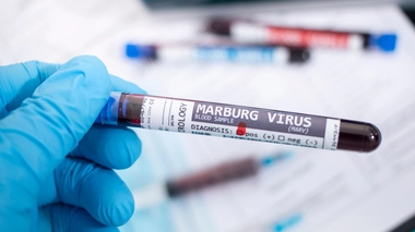 Le virus de Marburg continue de s'étendre en Afrique