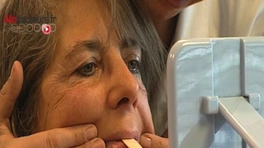 Paralysie faciale : quand le visage se fige