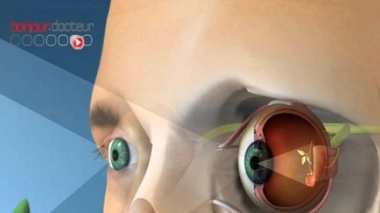 Pénurie d'ophtalmologistes : les orthoptistes à la rescousse