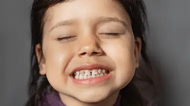pourquoi les enfants ont parfois des taches noires sur les dents ? 