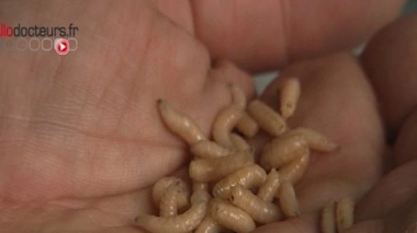 Des asticots pour soigner les plaies