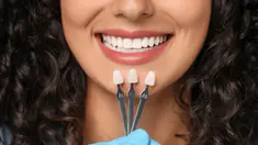 Risques, prix, indications... tout savoir sur les facettes dentaires