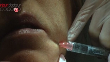 Après les implants PIP, les injections ?