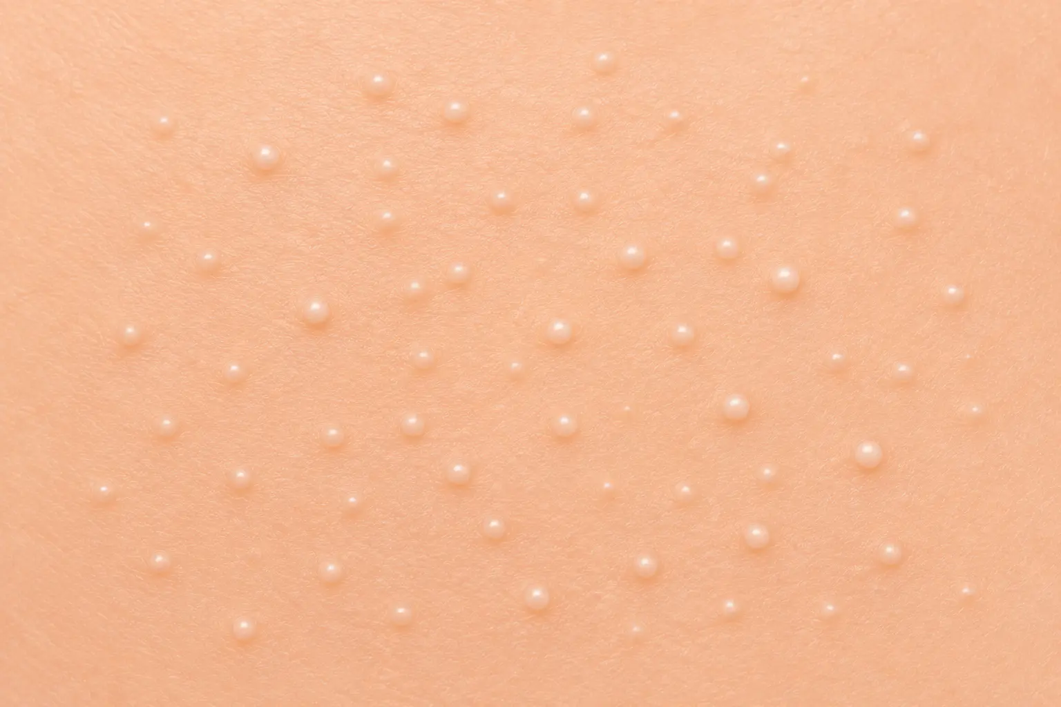 Grains de milium