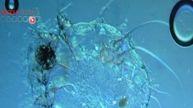 Des collégiens touchés par la gale