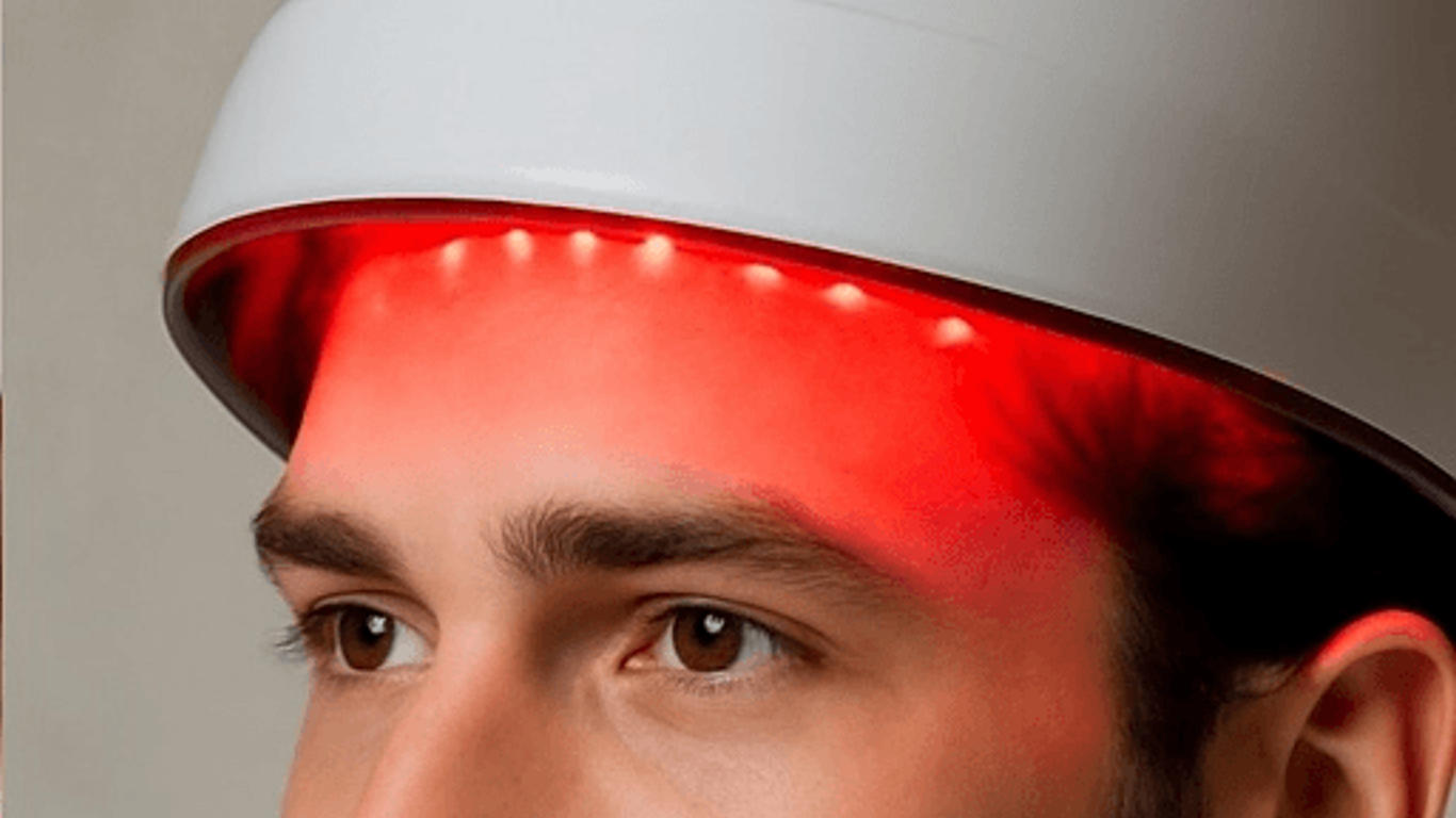 Perte de cheveux : les casques LED sont-ils vraiment efficaces ?