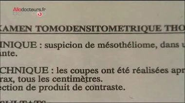 Le cancer de l'amiante devient une maladie à déclaration obligatoire