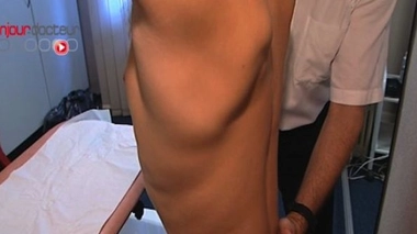 Comment savoir que l’on a un canal lombaire trop étroit ?