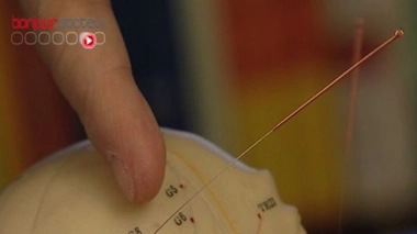 Les professionnels de l'acupuncture s'unissent