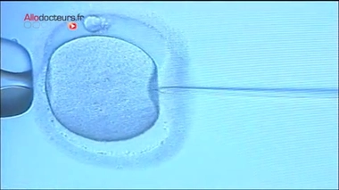 FIV : le transfert d'embyon toujours débattu