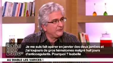 Varices : hématomes