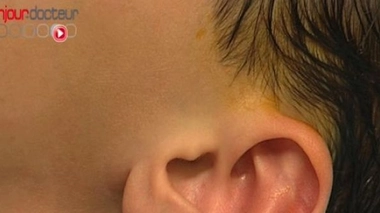 Le « Brain Prize » décerné à deux spécialistes de la surdité