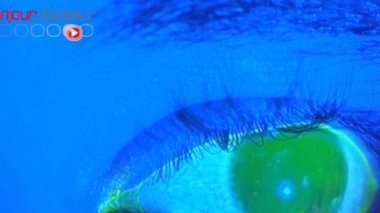 Appel aux candidats sur la santé visuelle à deux vitesses