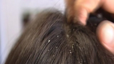 Hygiène des cheveux : démêler le vrai du faux