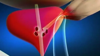 L'andropause : la ménopause au masculin