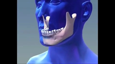 Comment se forme une carie ?