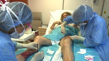 Cicatrisation : le recours à la greffe de peau