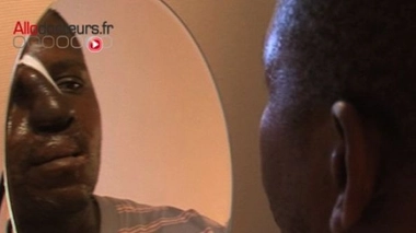 Défigurés, ils retrouvent un visage...