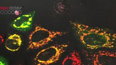 Un cancer sur six d'origine infectieuse