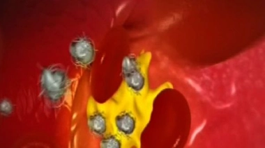 Les statines, un traitement préventif contre les maladies cardiovasculaires ?