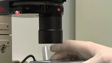 Oestrogènes : ils boostent la croissance des tumeurs