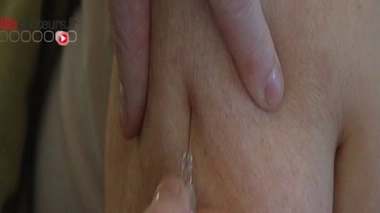 Un vaccin contre Parkinson en préparation