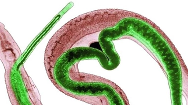 Brésil : un vaccin contre la bilharziose