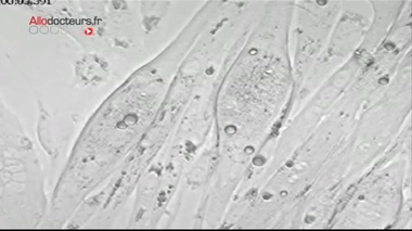 Les cellules souches plus fortes que la mort !