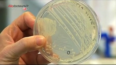 Un cas de peste détecté aux Etats-Unis