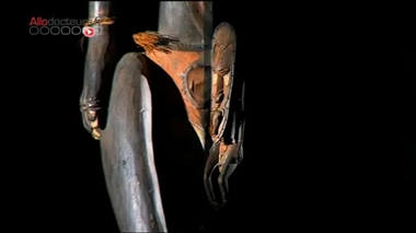 Arts premiers : foetus in foetu, un bébé dans le bébé