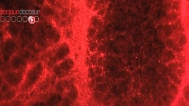 Epidémie de rougeole en Midi-Pyrénées