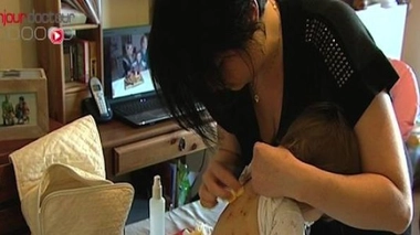 Regain de varicelle sur la France