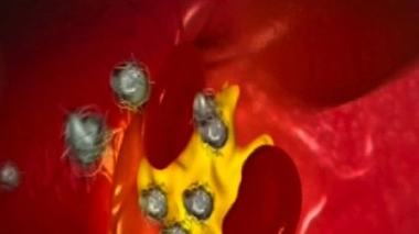 Les statines : bénéfiques pour le cœur malgré le risque de diabète