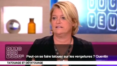 Peut-on se faire tatouer sur les vergetures ?