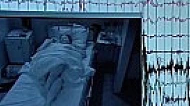 Le syndrome des jambes sans repos