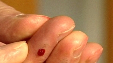 Diabète : vivre avec