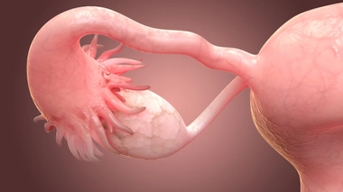 Kystes des ovaires : c'est grave docteur ?