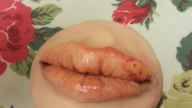 Vous reprendrez bien une part de gâteau en forme d'herpès ?