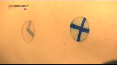 Un test sanguin pour une radiothérapie plus sûre