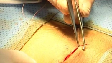 Ch@t : Chirurgie esthétique