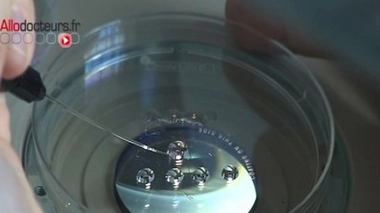 PMA : 22 000 naissances par an