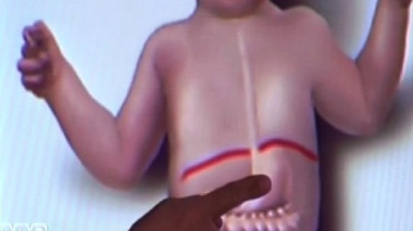 RGO des bébés, bien plus qu'un simple reflux