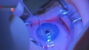 Défaut visuel : la correction de l'hypermétropie