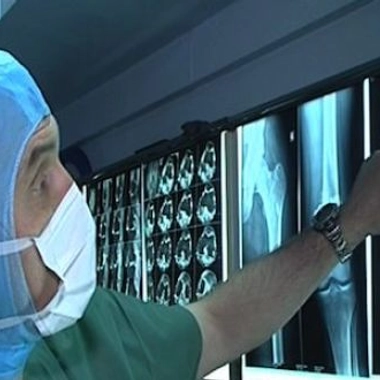 Tumeurs et chirurgie des os