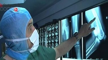 Tumeurs et chirurgie des os