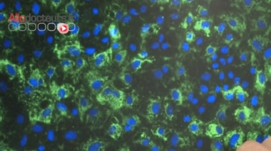 Cellules souches induites iPS : premières recherches cliniques en vue au Japon